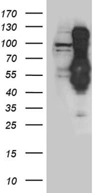 Polyclonal Rabbit anti-Human INCENP Antibody (WB)