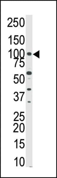 Polyclonal Rabbit anti-Human PKN3 Antibody (aa463-492, IHC, WB)