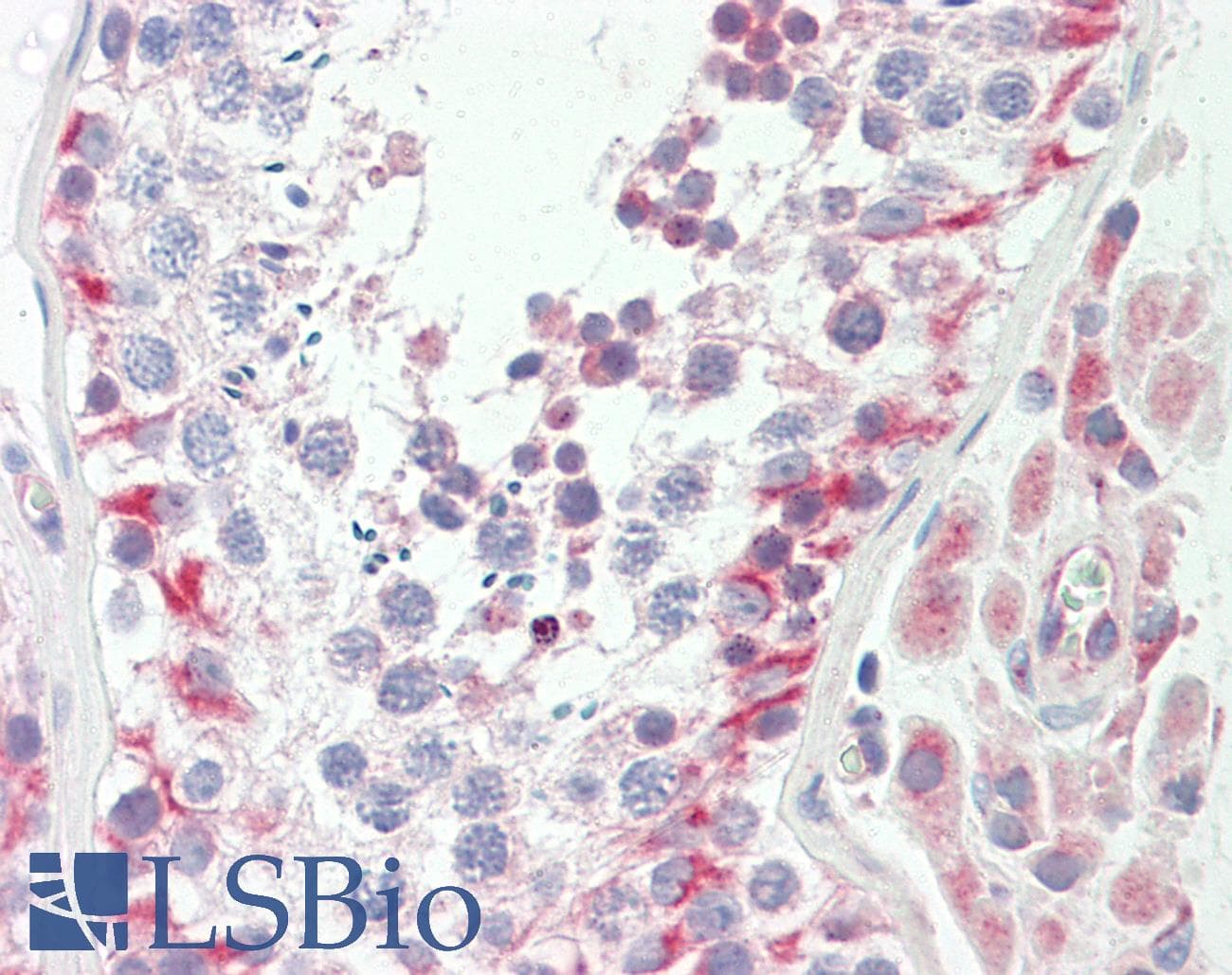IHC-plus™ QCR2 / UQCRC2 Antibody (aa235-264)
