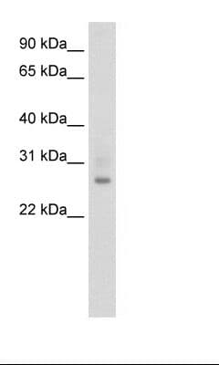 ATF1 Antibody (N-Terminus)