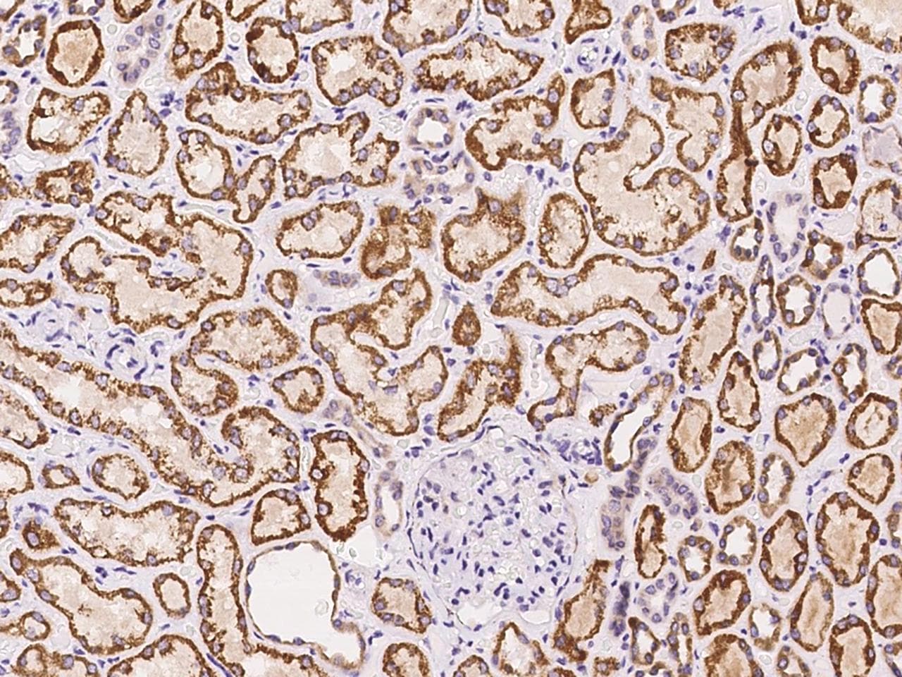 ETFBKMT Antibody