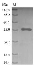 Human CRIP1 Protein (Recombinant GST, N-terminus)