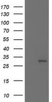 IHC-plus™ NNMT Antibody (clone 3E3)