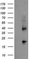 TBCC Antibody (clone OTI2B3)