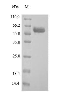 Human ARSB / Arylsulfatase B Protein (Recombinant 6His, N-terminus)