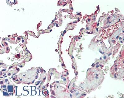 Polyclonal Rabbit anti-Human SIGLEC1 / CD169 / Sialoadhesin Antibody (aa1272-1411, IHC, WB)