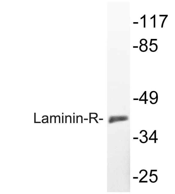 IHC-plus™ RPSA / Laminin Receptor Antibody (aa166-215)