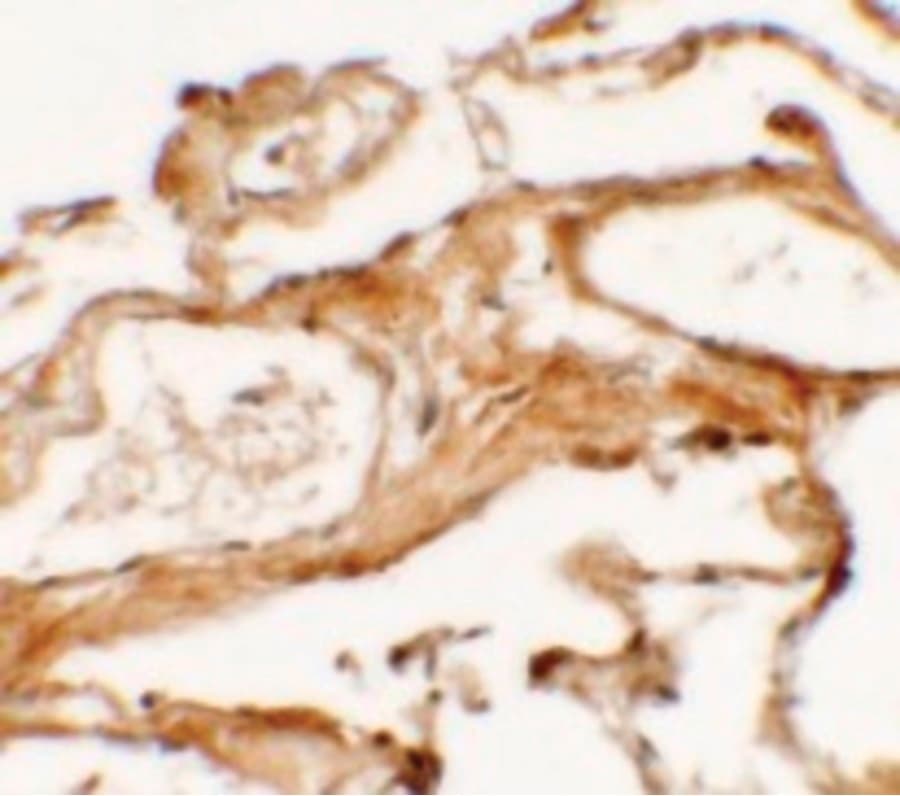 Polyclonal Rabbit anti-Human NBN / Nibrin Antibody (IHC, IF, WB)