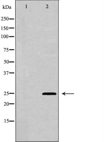 AK4 / Adenylate Kinase 4 Antibody