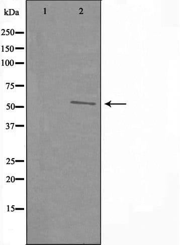 RAD23B / HR23B Antibody