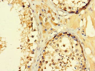 Polyclonal Rabbit anti-Human C2orf83 Antibody