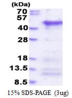 Human CCDC69 Protein (Recombinant His)