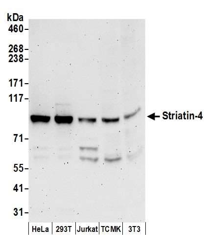 Polyclonal Rabbit anti-Human STRN4 Antibody (aa325-375, WB)