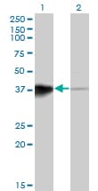 HOXB5 Antibody (clone 3F10)