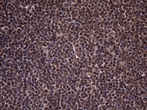 RNF20 Antibody (aa493-754, clone OTI2B9)