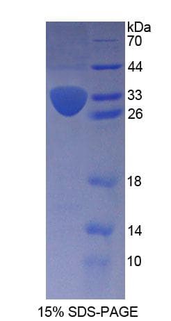 Human KTN1 / Kinectin Protein (Recombinant His-T7)