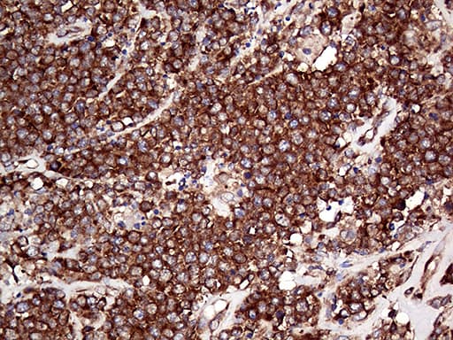 RPL10A Antibody (clone OTI4B2)