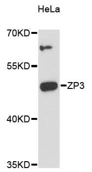 Polyclonal Rabbit anti-Human ZP3 Antibody (WB)