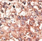 BMP5 Antibody (aa16-46)