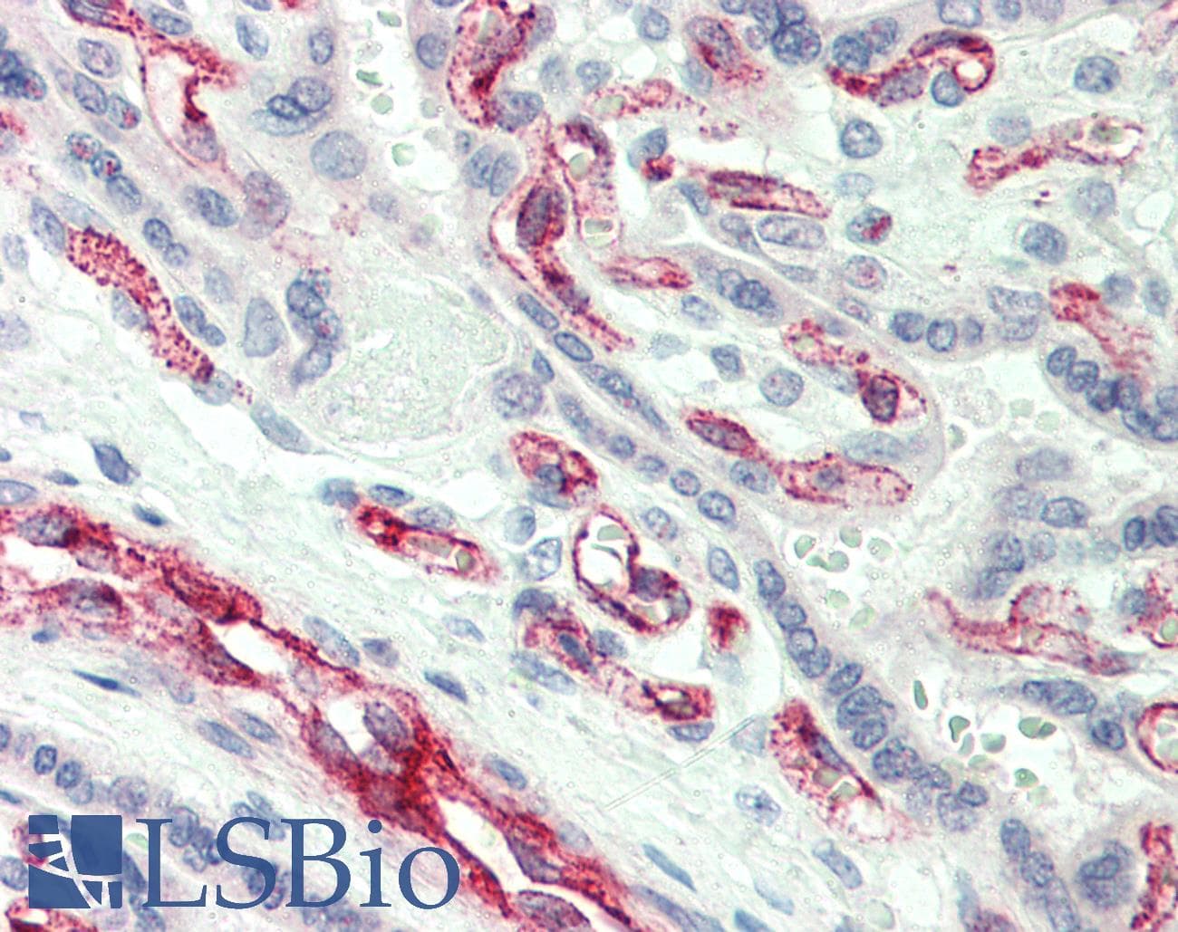 IHC-plus™ Polyclonal Rabbit anti-Human CASP2 / Caspase 2 Antibody (IHC, WB)