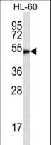 HDAC3 Antibody (aa383-412)