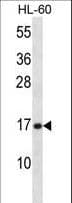 PLA2G5 Antibody (aa103-132)