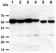 DKK3 Antibody (clone AT103B5)