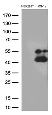 Monoclonal Mouse anti-Human CD38 Antibody (clone OTI1C9, aa43-300, IHC, WB)