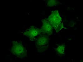 KIAA0153 / TTLL12 Antibody (clone OTI5H3)