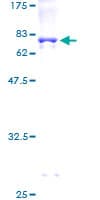 Human RUNDC3A Protein (Recombinant GST)