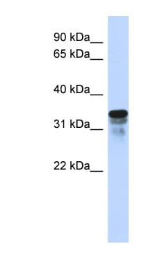 Polyclonal Rabbit anti-Human FAM82B Antibody (N-Terminus, WB)