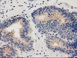 Monoclonal Mouse anti-Human HDAC6 Antibody (clone OTI5E6, IHC, IF, WB)