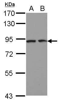 Polyclonal Rabbit anti-Human DCBLD2 Antibody (IHC, WB)
