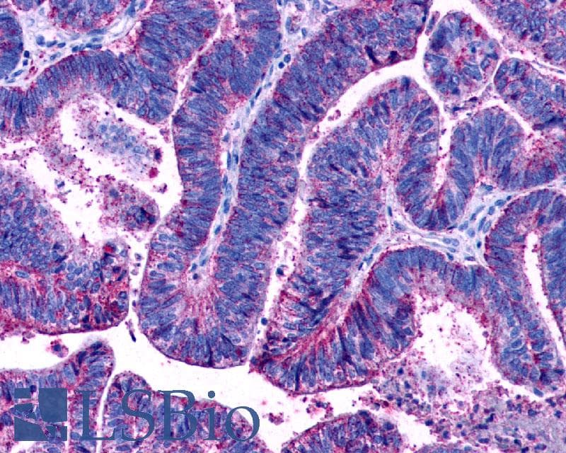 PathPlus™ Polyclonal Rabbit anti-Human LPAR3 / LPA3 / EDG7 Antibody (Cytoplasmic Domain, IHC)