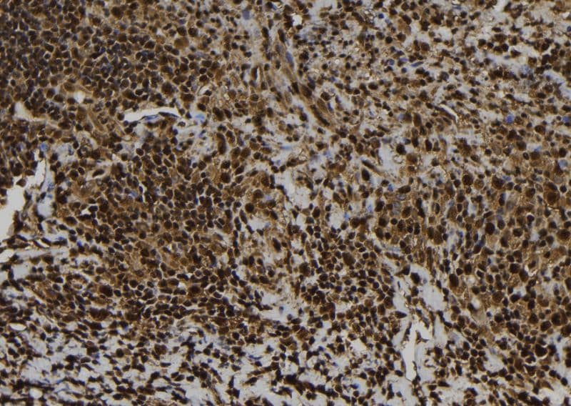 EIF5A Antibody