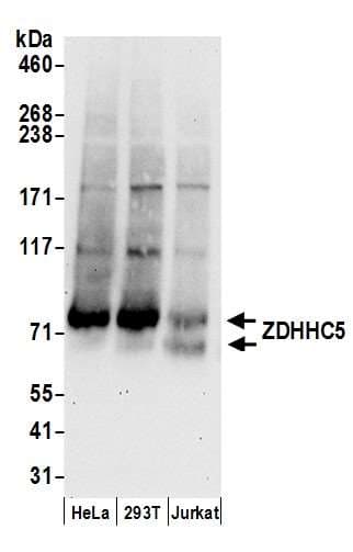 ZDHHC5 Antibody (aa500-550)
