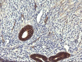 Monoclonal Mouse anti-Human TRIM38 Antibody (clone OTI16D9, IHC, WB)