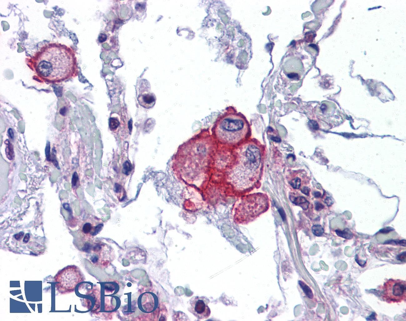 IHC-plus™ VRL1 / TRPV2 Antibody
