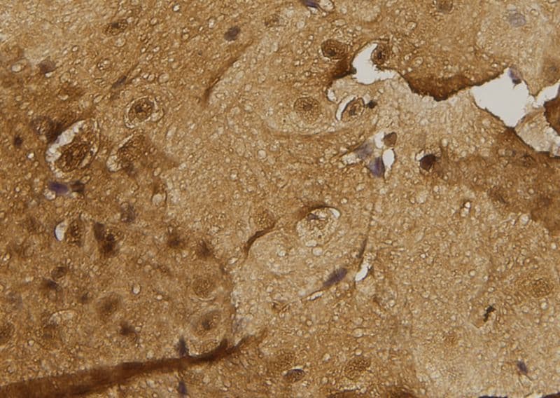 MAP2K3 / MEK3 / MKK3 Antibody