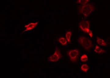 CHST2 Antibody