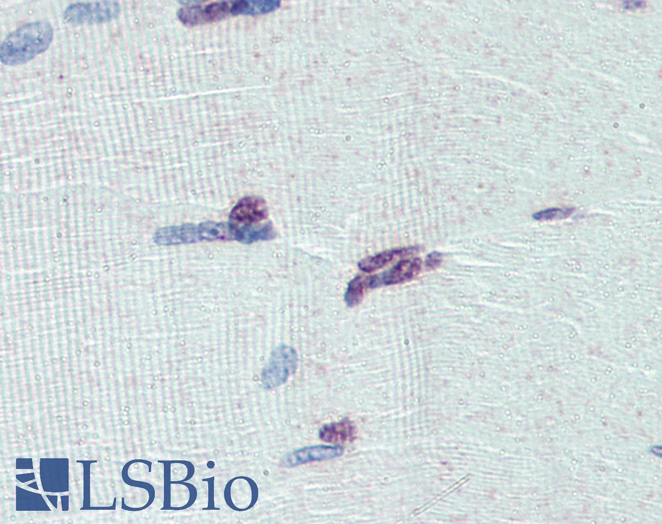 Polyclonal Rabbit anti-Human PRDM9 Antibody (aa431-480, IHC, WB)