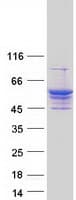 Human LPCAT4 Protein (Recombinant Myc-DDK (Flag))
