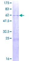 Human ST6GALNAC4 Protein (Recombinant GST)