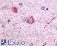 PathPlus™ Polyclonal Rabbit anti-Human NTSR1 / NTR Antibody (N-Terminus, IHC)