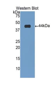 TNNT2 / CTNT Antibody (aa2-100)