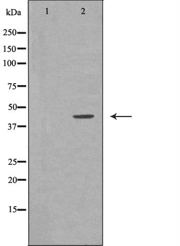 Polyclonal Rabbit anti-Human GNA11 Antibody (IHC, WB)
