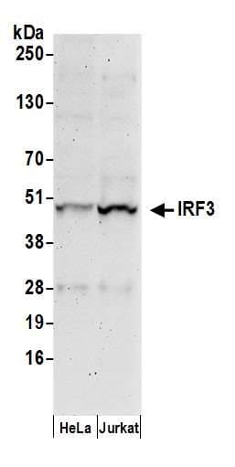 Polyclonal Rabbit anti-Human IRF3 Antibody (aa100-150, IHC, WB)