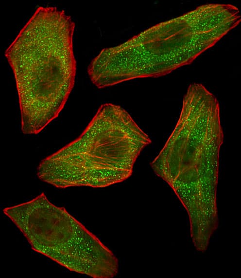PIK3R3 / p85 Gamma Antibody (aa316-346)
