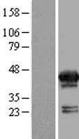 MVK Protein (Over-Expression Lysate Myc-DDK (Flag))