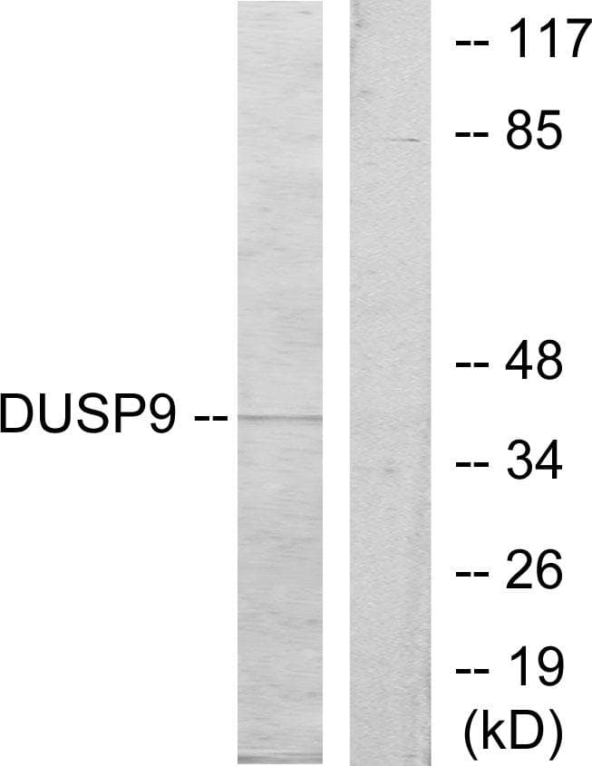 DUSP9 Antibody